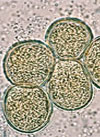 pollenundallergie.ch - Roggen - Pollen