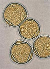 pollenetallergie.ch - Bouleau - Bouleau verruqueux – Pollen de bouleau