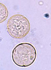 pollenundallergie.ch - Ampferpollen