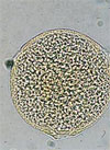 pollenundallergie.ch - Buche - Buchenpollen