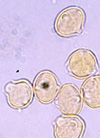 pollenundallergie.ch - Edelkastanie, Esskastanie – Pollen