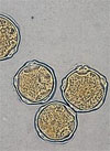pollenundallergie.ch - Gewöhnliche Hasel – Corylus avellana L. - Verkehrt-eiförmiges, rundliches, gezähntes Blatt