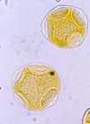 pollenundallergie.ch - Hain- oder Hagebuche - Pollen