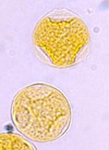 pollenundallergie.ch - Hopfenbuche – Ostrya carpinifolia – Hopfenbuchenpollen Grösse: 23–28 µm