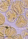 pollenundallergie.ch - Ölbaum - Pollen