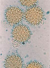 pollenundallergie.ch - Sonnenblume - Pollen