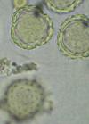 pollenetallergie.ch - Ambroisie – Ambrosia artemisiifolia L. - Pollen