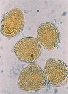 pollenetallergie.ch - Chêne pédonculé - pollen