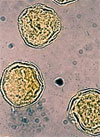 pollenetallergie.ch - Peuplier hybride euraméricain - Pollen