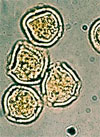 pollenetallergie.ch - Platane à feuilles d'érable – Pollen du platane