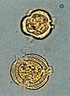 pollinieallergie.ch - Artemisia comune - Pollen