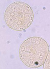 pollinieallergie.ch - Piantaggine minore P. lanceolata - Polline